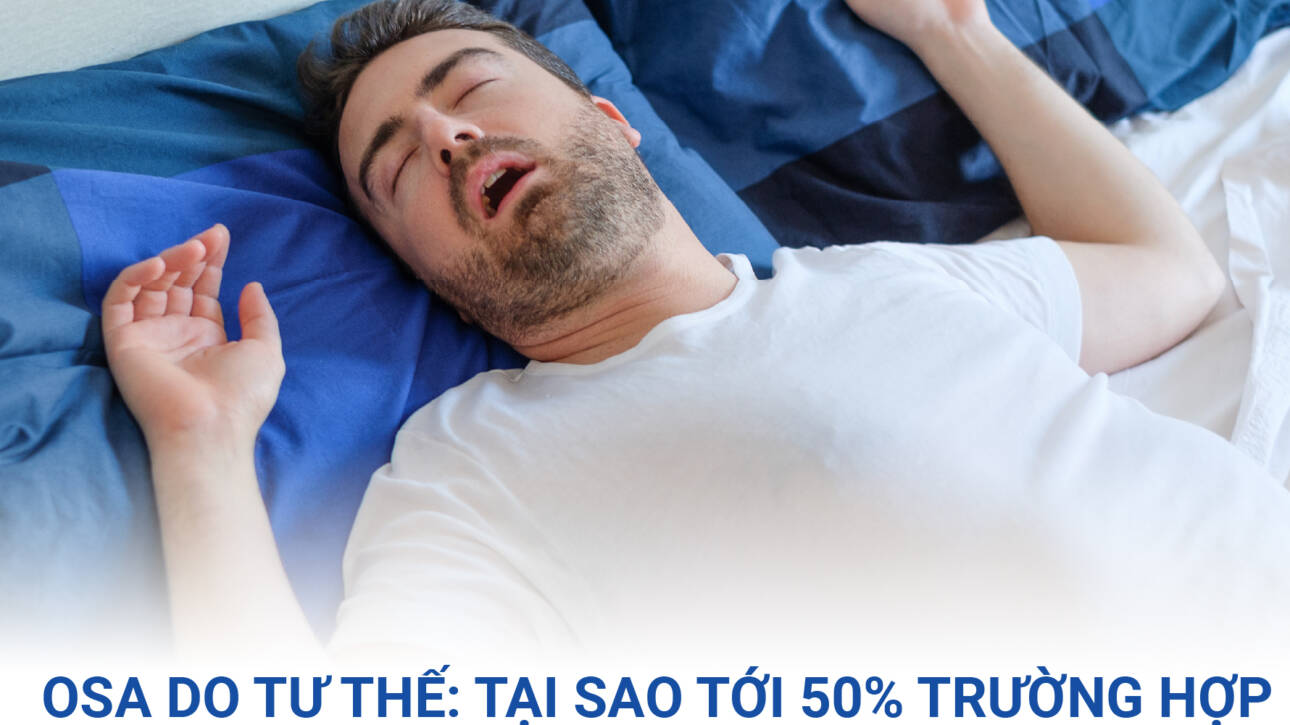 osa-do-tu-the-va-lieu-phap-tu-the