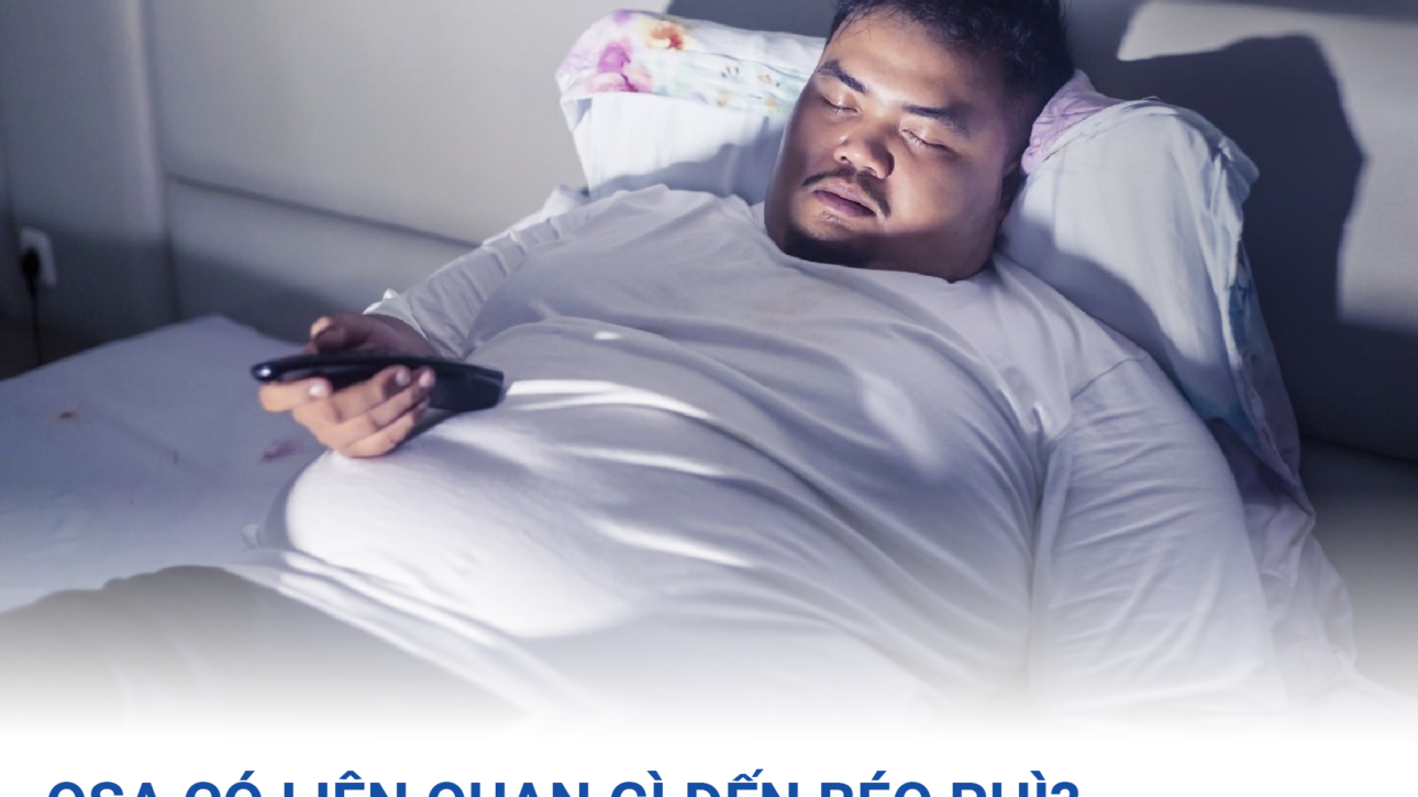 osa-va-beo-phi-moi-quan-he-2-chieu