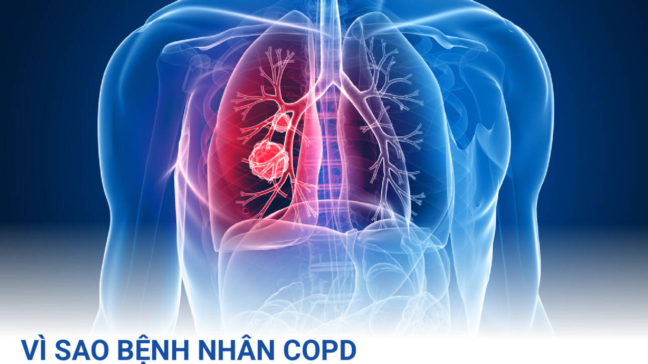 VI-SAO-BENH-NHAN-COPD-DE-MAC-NGUNG-THO-KHI-NGU-OSA