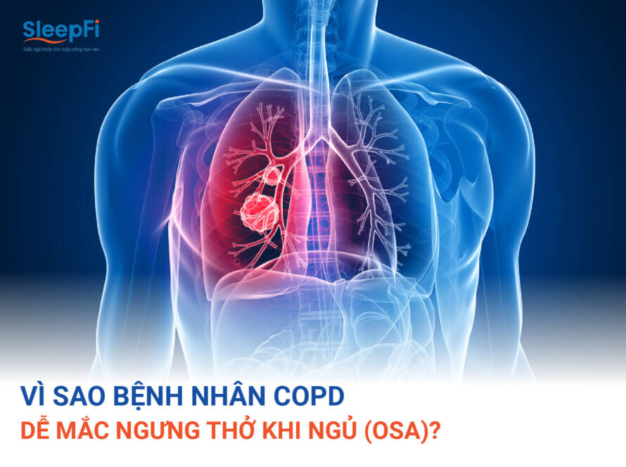 VI-SAO-BENH-NHAN-COPD-DE-MAC-NGUNG-THO-KHI-NGU-OSA