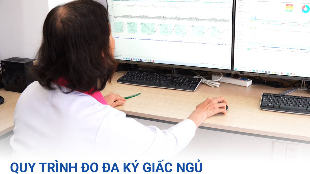 do-da-ky-giac-ngu-polysomnography-sleepfi