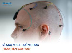 MSLT